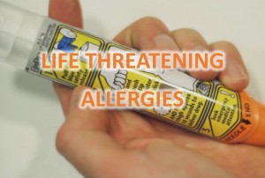 Life threatening allergies icon